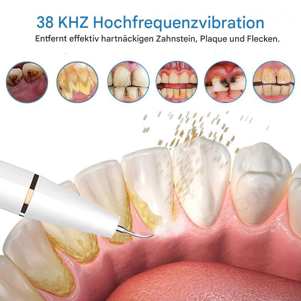 Ultrasonic Dental Tartar Remover | Plaque & Calculus Cleaner